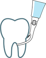 Ultrasonic Teeth Cleaning / Scaling
